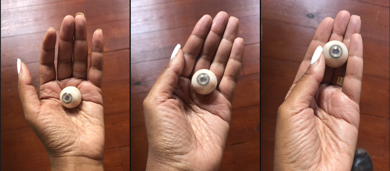 Finding the eye: three photos of one prosthetic blue-gray eye rolling about an open palm, white-tipped nails, gold ring