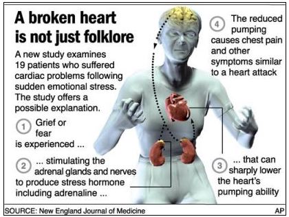 AP news graphic 'A broken heart is not just folklore': a grey figure with heart, brain, kidneys and numbered steps explaining stress-hormone cardiomyopathy, after the New England Journal of Medicine
